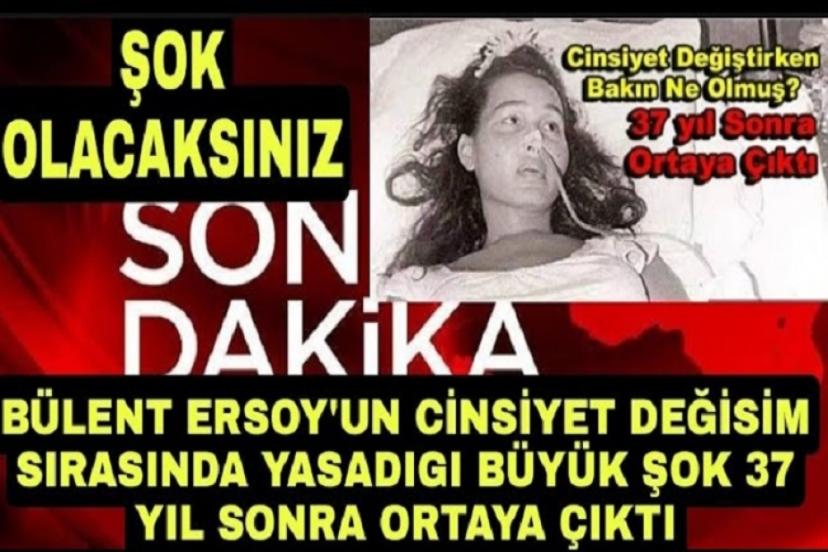 Bülent Ersoy'un cinsiyet değiştirirken yaşadığı büyük şok!