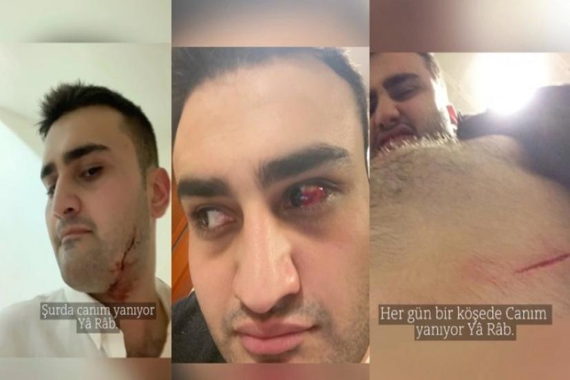 Dünyaca ünlü Türk fenomenin son hali dehşete düşürdü!
