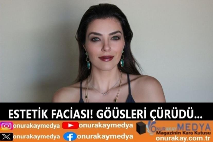 Kadınları uyardı! Ünlü mankenin göğüsleri neden çürüdü?