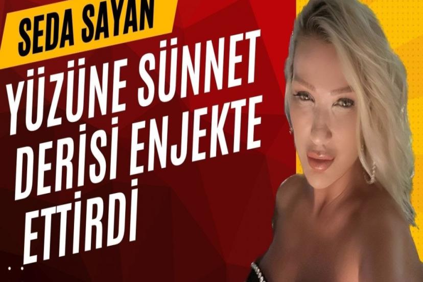 Seda Sayan yüzüne sünnet derisinden sıvı enjekte ettirdi