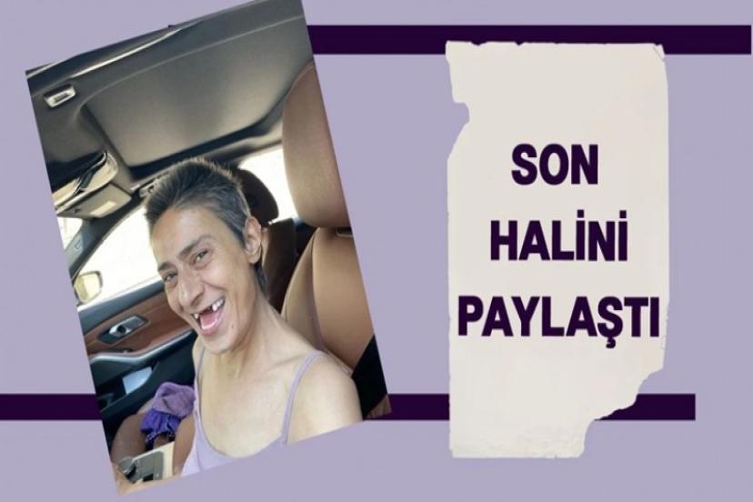 Yıldız Tilbe önce korkuttu sonra güldürdü!